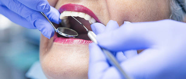 Best Emergency Broken Tooth Repair in Birngham, MI