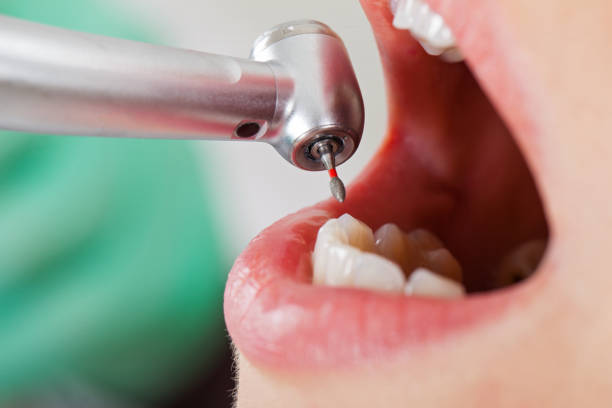 Best Pediatric Emergency Dentist in Birngham, MI